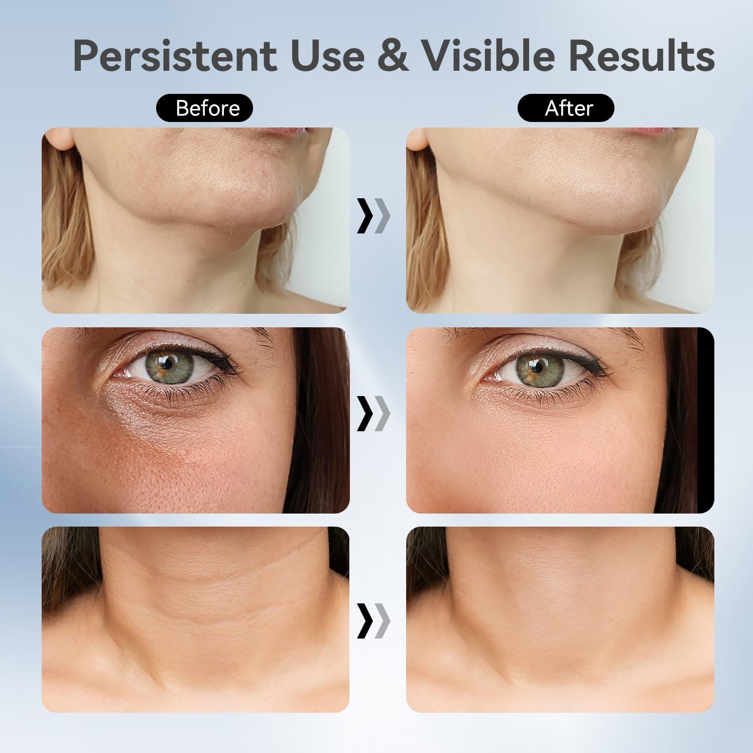 Neck Face Massager, 3-In-1 Portable Facial Massager, Face Sculpting Tool, At-Home Face Device for Skin Care(White)